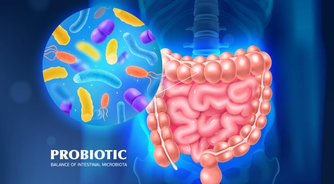 pool de probióticos ajudam a fortalecer o intestino e reduzem os sintomas da psoríase