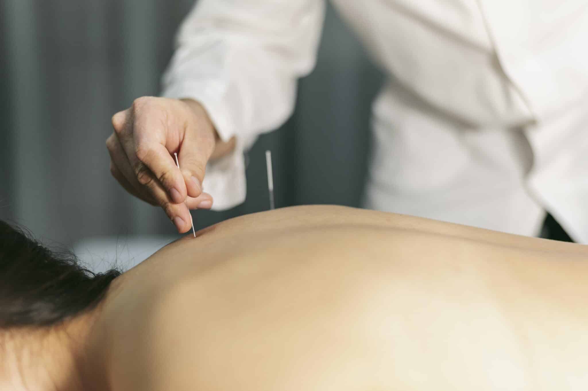A UTILIDADE DA ACUPUNTURA COMO PRÁTICA INTEGRATIVA PARA PACIENTES COM DOENÇAS AUTOIMUNES