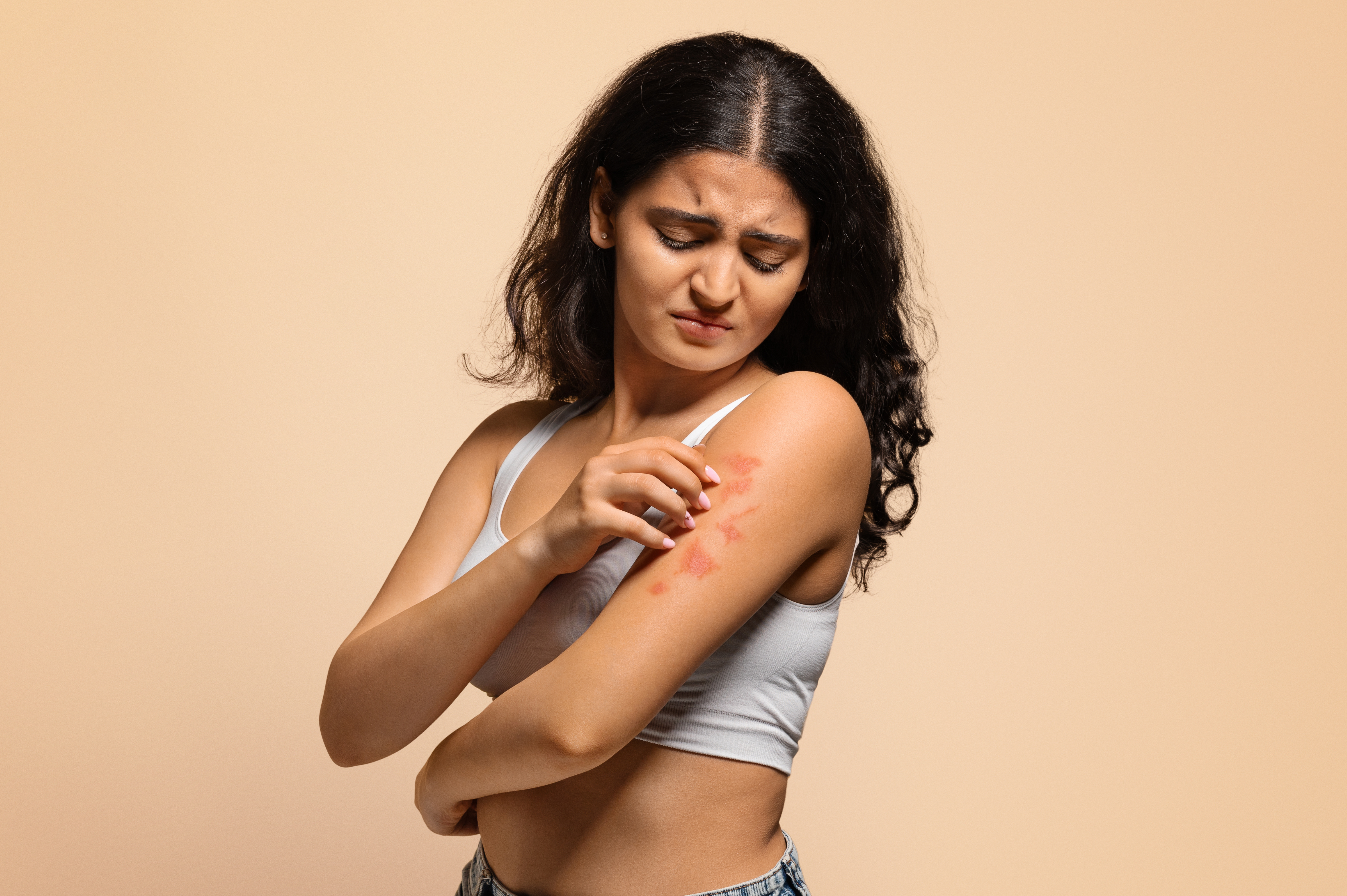 POR QUE A PSORÍASE VAI ALÉM DA PELE? ENTENDA OS IMPACTOS FÍSICOS, EMOCIONAIS E SISTÊMICOS